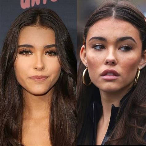 madison beer plastic surgery|Madison Beer Has Addressed Plastic Surgery Rumors。